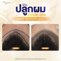 Salepage Review