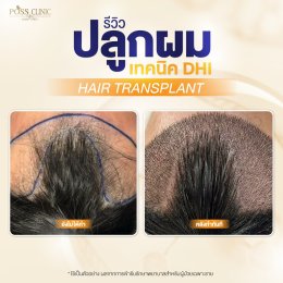 Salepage Review