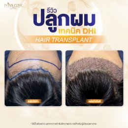 Salepage Review