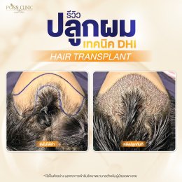 Salepage Review