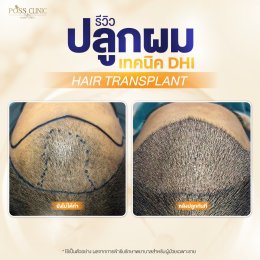 Salepage Review