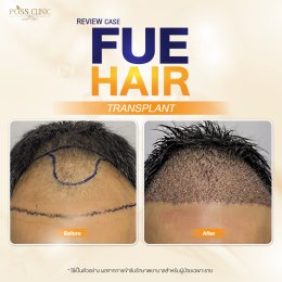 Review-en