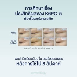 K6PC-5 vs Retinol สารสกัดลดริ้วรอยตัวไหนดีกว่ากันสำหรับคนผิวบอบบางและกลัวหน้าลอก?
