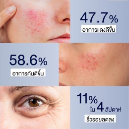วิธีซ่อม Skin Barrier ให้แข็งแรงเร่งด่วน: เจาะลึกนวัตกรรม กู้หน้าพัง ระดับเซลล์ด้วย Dermartlogy ATG Serum