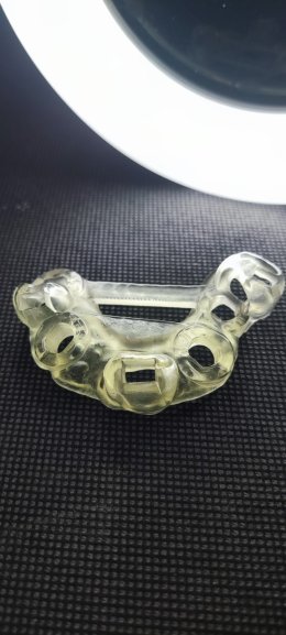 Neobiotech implant all on