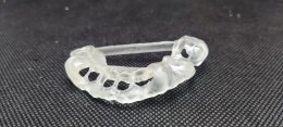 Neobiotech implant