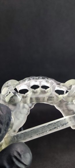 Neobiotech implant