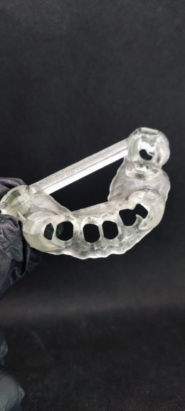 Neobiotech implant