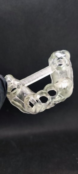 Neobiotech implant