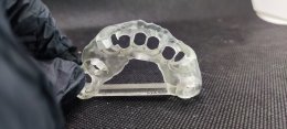 Neobiotech implant
