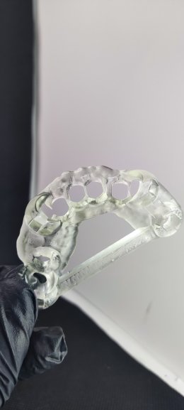 Neobiotech implant