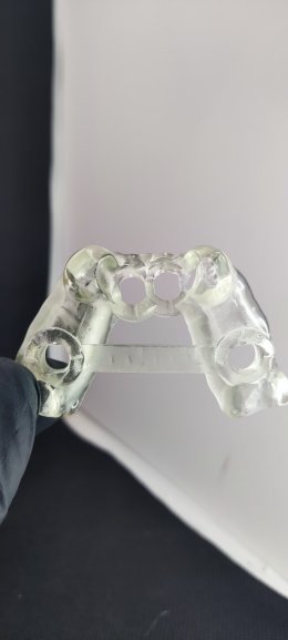 Neobiotech implant