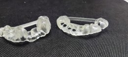 Neobiotech implant