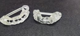 Neobiotech implant