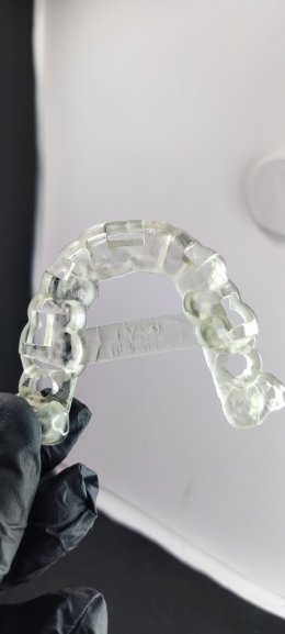 Neodent Implant