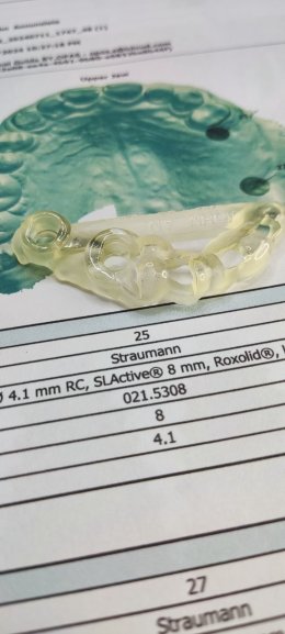 Straumann Implant