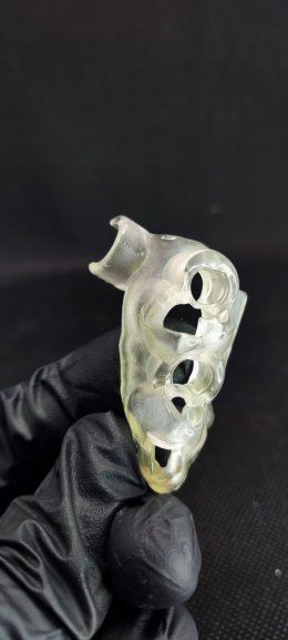 Straumann Implant