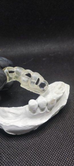 Dentium implant