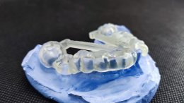 Dentis Implant