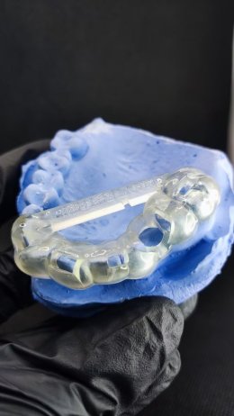 Dentis Implant