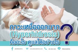 ภาวะเหงื่อออกมาก (Hyperhidrosis) คืออะไร ดูแลได้อย่างไร