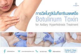 การฉีดโบทูลินั่มท็อกซินลดเหงื่อ Botulinum Toxin for Axillary Hyperhidrosis Treatment