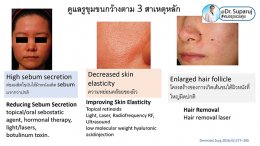 รูขุมขนกว้าง Enlarged Facial Pore ดูแลได้อย่างไร Part II?