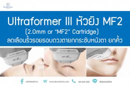 Ultraformer lll หัวยิง MF2 (2.0mm or “MF2” Cartridge) ลดเลือนริ้วรอยรอบดวงตายกกระชับหนังตา ยกคิ้ว