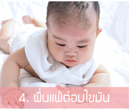 4 ปัญหาผดผื่นผิวลูก (ที่อาจเกิดขึ้น) ช่วงหลังคลอด