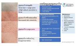 รูขุมขนกว้าง Enlarged Facial Pore เกิดจากอะไร ? + เทคนิคดูแลด้วยโปรแกรม Discovery Pico Laser หลายความยาวคลื่น +หลายพลังงานร่วมกัน