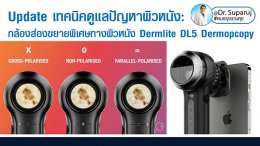 Update เทคนิคดูแลปัญหาผิวหนัง:กล้องส่องขยายพิเศษทางผิวหนัง Dermlite DL5 Dermopcopy