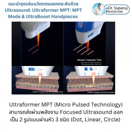 แนะนำนวัตกรรม พลังงานเครื่องเสียง Macro & Micro Focused Ultrasound ยกกระชับผิว Ultraformer MPT: จุดเด่น + ทดสอบลักษณะพลังงาน + การประเมินลักษณะผิว ให้เห็นกันชัดๆเลยครับ