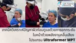 แนะนำเทคนิคยกกระชับผิว ด้วยพลังงานคลื่นเสียง MMFU Focused Ultrasound โปรแกรม Ultraformer MPT