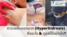 แนะนำเทคนิคดูแลโรคผิวหนัง: ภาวะเหงื่อออกมาก (Hyperhidrosis) คืออะไร & ดูแลได้อย่างไร?