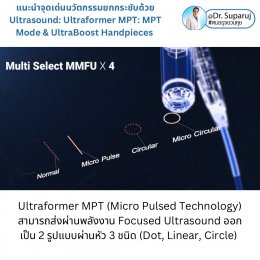 แนะนำนวัตกรรม พลังงานเครื่องเสียง Macro & Micro Focused Ultrasound ยกกระชับผิว Ultraformer MPT: จุดเด่น + ทดสอบลักษณะพลังงาน + การประเมินลักษณะผิว ให้เห็นกันชัดๆเลยครับ