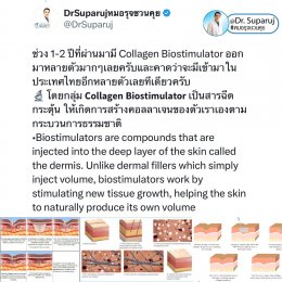 Update เทคนิคกระตุ้นการสร้างคอลลาเจนในผิวหนังลดเลือนริ้วรอย: Collagen Biostimulator