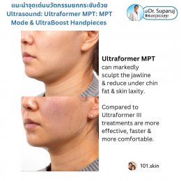 แนะนำนวัตกรรม พลังงานเครื่องเสียง Macro & Micro Focused Ultrasound ยกกระชับผิว Ultraformer MPT: จุดเด่น + ทดสอบลักษณะพลังงาน + การประเมินลักษณะผิว ให้เห็นกันชัดๆเลยครับ