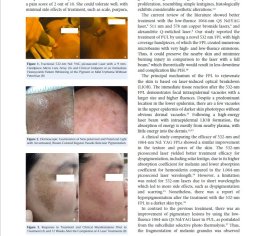 แนะนำเทคนิคดูแลโรคผิวหนัง: ภาวะเหงื่อออกมาก (Hyperhidrosis) คืออะไร & ดูแลได้อย่างไร?