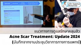 Update แนวทางการดูแลรักษาหลุมสิว Acne Scar Treatment: Update 2024 (บันทึกจากงานประชุมวิชาการทางการแพทย์ครับ) หมอมีบันทึกจากงานประชุมล่าสุดที่หมอได้รับเกียรติเป็นวิทยากรมาฝากกันครัข หมอได้สรุปเทคนิคการรักษาหลุมสิวต่างๆทั้งของเดิมและของใหม่มาฝากกัน อันนี้ตั