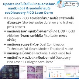 Update เทคโนโลยีใหม่ เทคนิคการรักษาหลุมสิว เม็ดสี & จุดเด่นที่น่าสนใจของ Discovery PICO Laser Derm