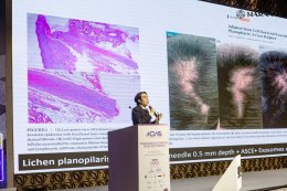 Myanmar Dermatologic Surgery & Aesthetic Society (MDAS) 2025