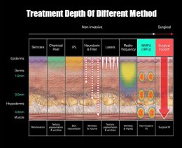 Recap เทคนิคยกกระชับผิว Skin Tightening 2025-2026