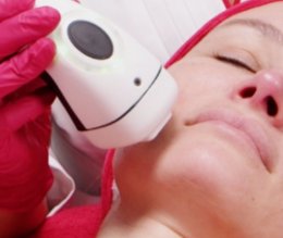 เทคนิคดูแลปัญหาหลุมสิว แผลเป็น รูขุมขนกว้าง ด้วย Fractional non ablative 1470 nm Laser: Program LaserME