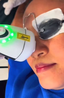 หลุมสิวที่มีรอยแดง Post Acne Redness and Acne Scar เกิดจากอะไร & ดูแลได้อย่างไร ?