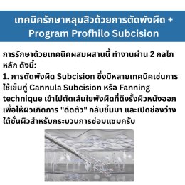 เทคนิครักษาหลุมสิว ด้วยการตัดพังผืดหลุมสิวเทคนิค Program Profhilo Bio-Remodeling Fanning Subcision Techniques for Acne Scar Treatment