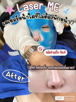 ขอบคุณคุณจูน @jirasuri มากนะครับที่ไว้วางใจให้หมอได้ดูแลปัญหาเรื่องรูขุมขนและจุดด่างดำด้วย โปรแกรม LaserME ครับผม