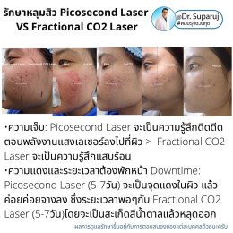 เจาะลึกความแตกต่าง: Fractional CO2 vs Fractional Picosecond Laser ในการรักษาหลุมสิว