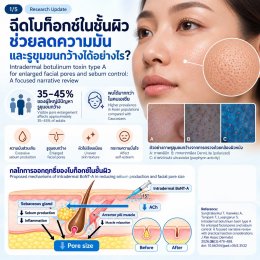 งานวิจัยทบทวน: การฉีด Botulinum Toxin Type A ในชั้นผิวเพื่อช่วยลดความมันและรูขุมขนกว้าง
