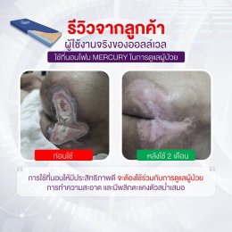 รีวิว ALLWELL ที่นอนโฟมป้องกันแผลกดทับ ที่รพ.ใช้ รุ่น Mercury หนา 15 ซม. ดีกว่าที่นอนลม