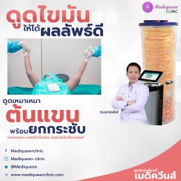 รีวิวดูดไขมันต้นแขน